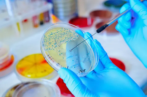 A Microbiologia é crucial para entendermos como os microrganismos afetam nossa saúde, tanto positivamente (auxiliando na digestão e na imunidade) quanto negativamente (causando doenças). Através dela, podemos desenvolver tratamentos e medidas preventivas para combater doenças infecciosas e promover a saúde. 💉💊